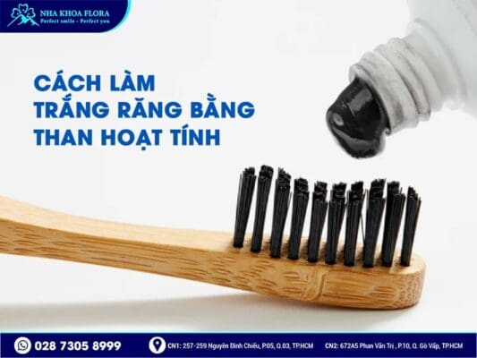 cách làm trắng răng - ảnh 3