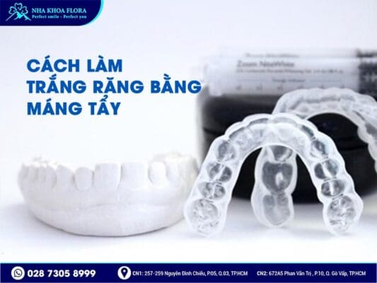 cách làm trắng răng - ảnh 4