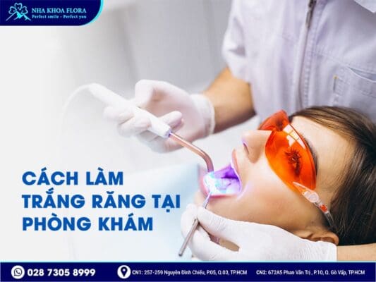 cách làm trắng răng - ảnh 5