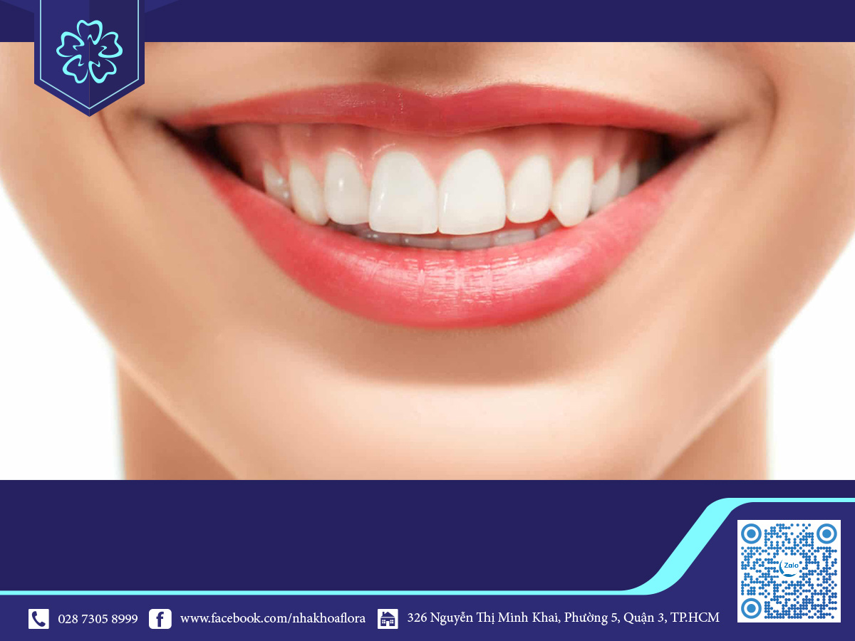 cuoi-ho-loi-flora-06