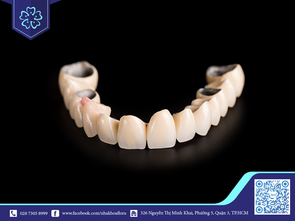 boc-rang-su-toan-ham-nha-khoa-flora