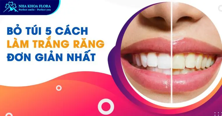 Bỏ túi 5 cách làm trắng răng đơn giản, dễ làm nhất! 4