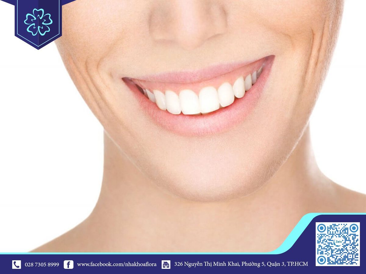 chua-cuoi-ho-loi-flora