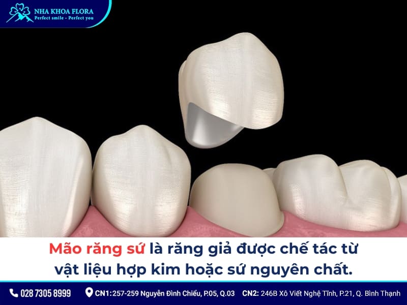 mão răng sứ