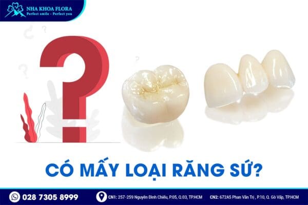 Nên bọc răng sứ loại nào? - Ảnh 1