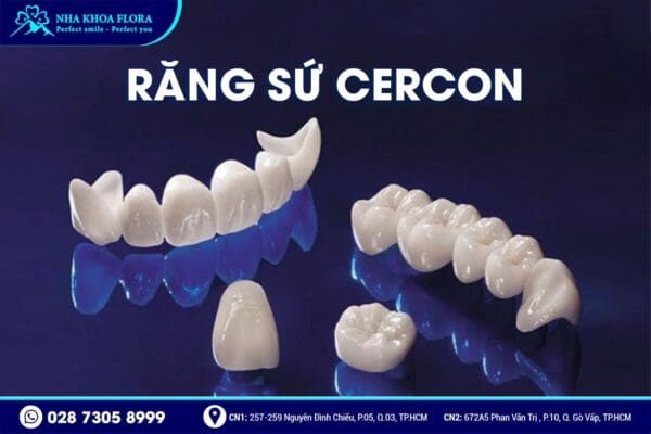 Nên bọc răng sứ loại nào? - Ảnh 4