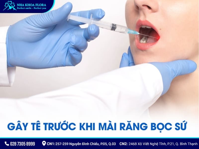 quy trình bọc răng sứ