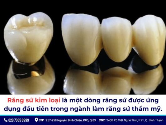 Tác hại của răng sứ kim loại - ảnh 1