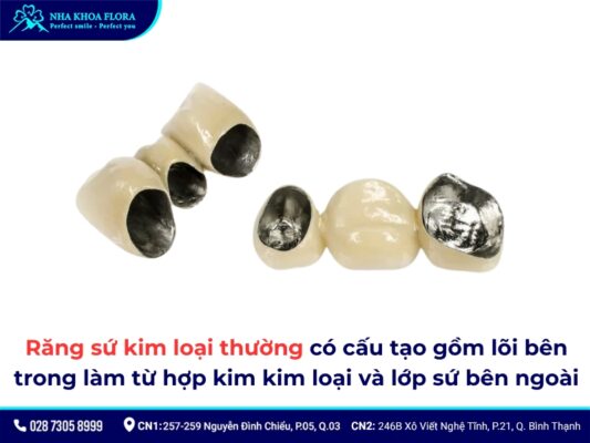 Tác hại của răng sứ kim loại - ảnh 2
