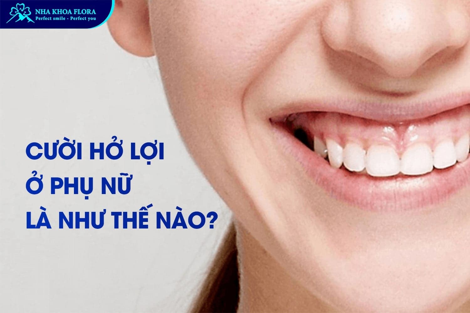 Phụ Nữ Cười Hở Lợi Tướng Số Là Tốt Hay Xấu? - ảnh 1