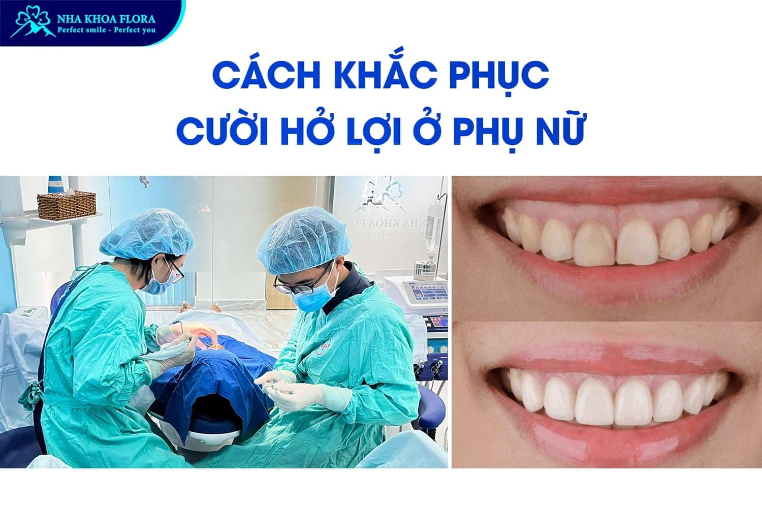 Phụ Nữ Cười Hở Lợi Tướng Số Là Tốt Hay Xấu? - ảnh 3