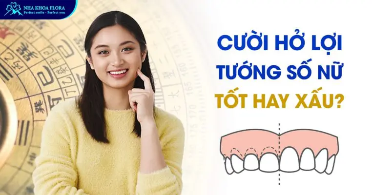 Phụ Nữ Cười Hở Lợi Tướng Số Là Tốt Hay Xấu? 4