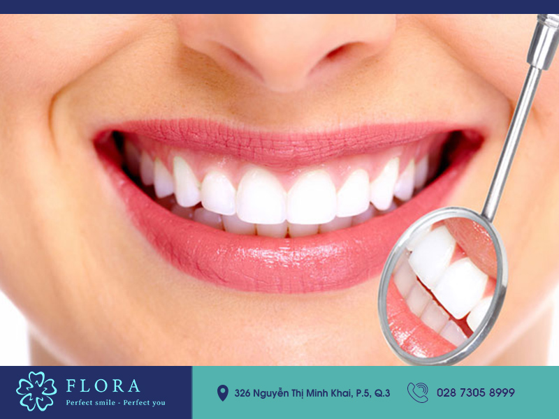 bang-gia-cham-soc-rang-toan-dien-tai-flora bang-gia-cham-soc-rang-toan-dien-tai-flora