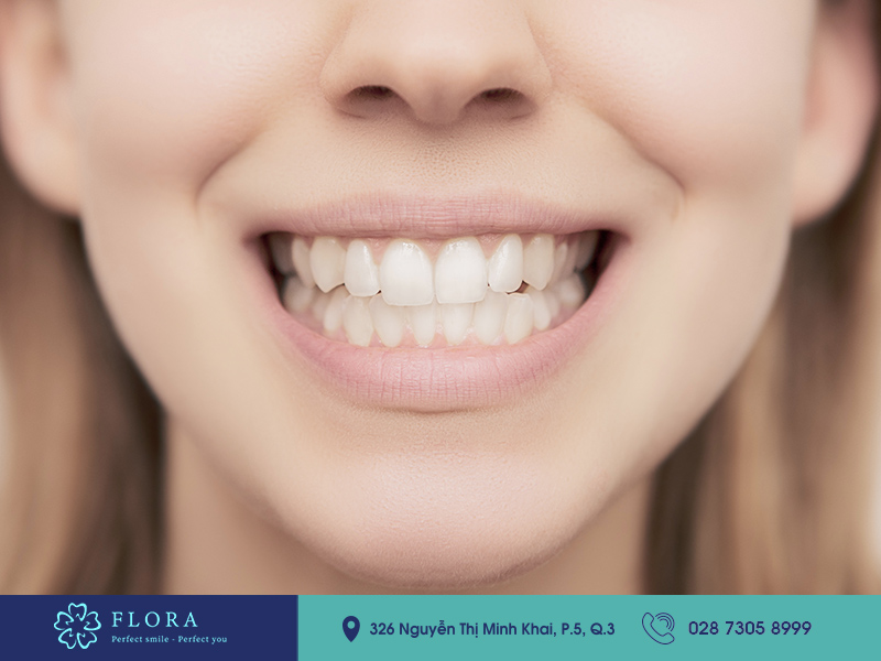 cuoi-ho-loi-tuong-so-dan-ba