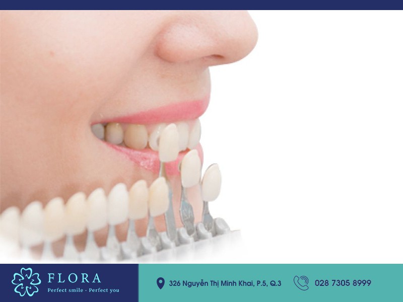 phương pháp làm trắng răng 