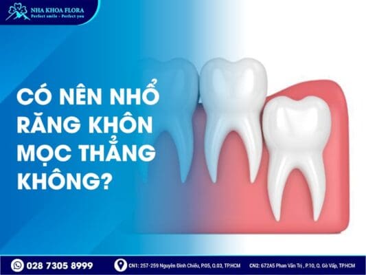 Có nên nhổ răng khôn - ảnh 2