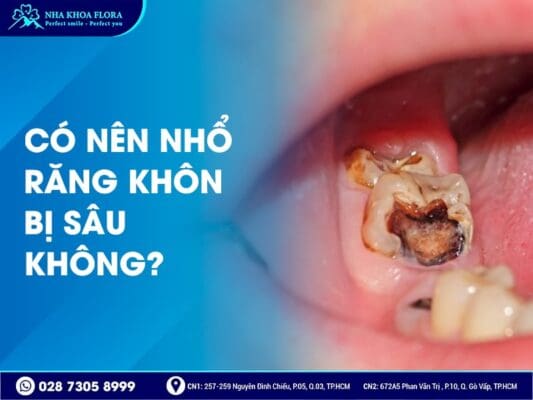Có nên nhổ răng khôn - ảnh 3