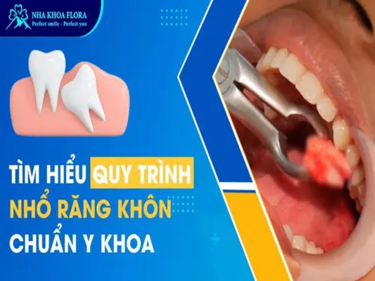 Tìm hiểu quy trình nhổ răng khôn chuẩn Y khoa 1
