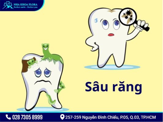 bệnh răng miệng - ảnh 1