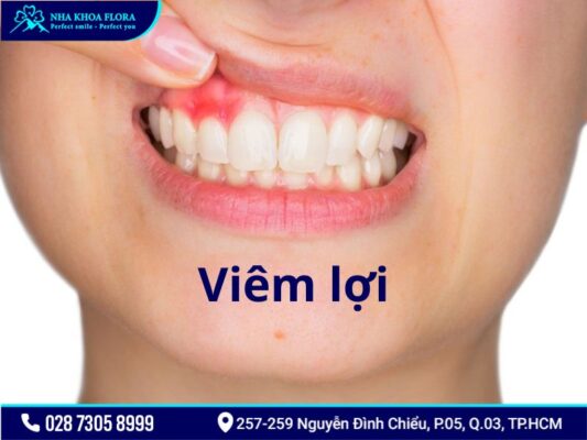bệnh răng miệng - ảnh 2