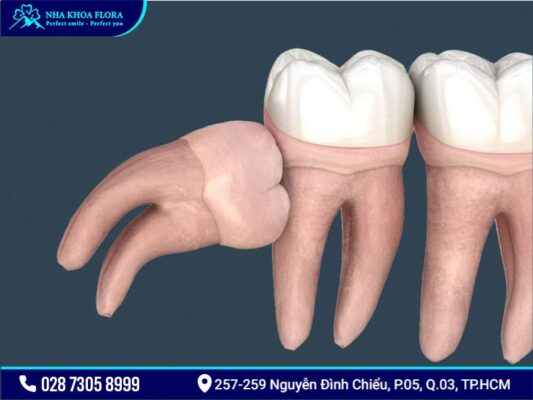 bệnh răng miệng - ảnh 9