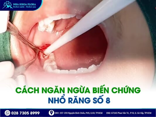 biến chứng sau khi nhổ răng khôn - ảnh 3