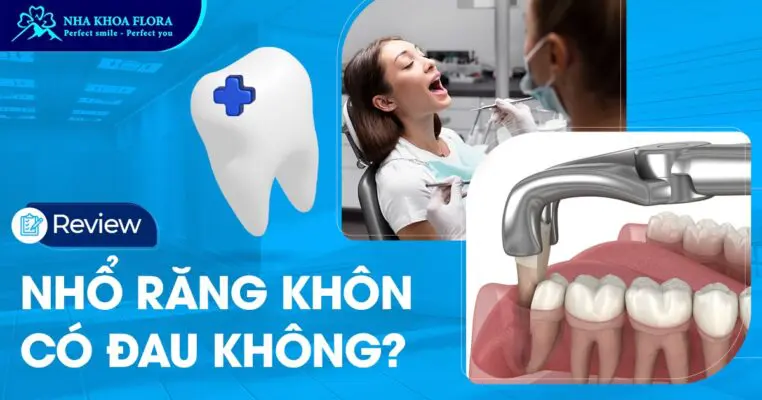 Review nhổ răng khôn có đau không chi tiết nhất 1