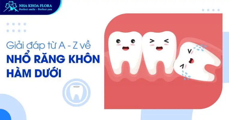 Giải đáp từ A – Z về nhổ răng khôn hàm dưới 2