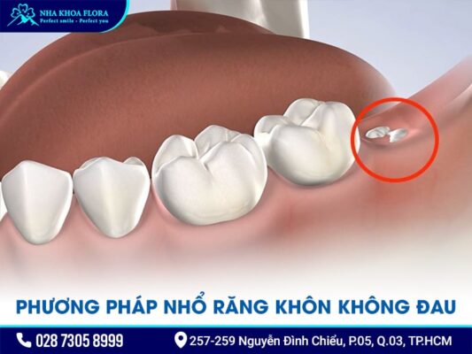 Phương pháp nhổ răng khôn không đau - ảnh 2