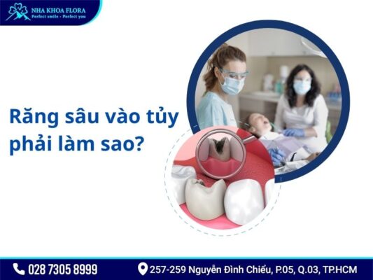 răng sâu vào tủy - ảnh 3 răng sâu vào tủy - ảnh 3