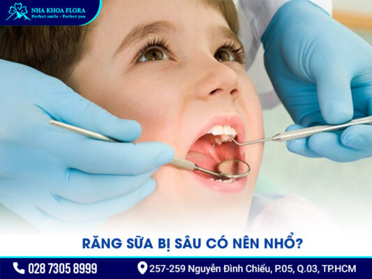 răng sữa bị sâu - ảnh 3