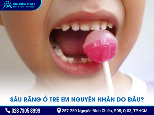 Sâu răng ở trẻ em - ảnh 1