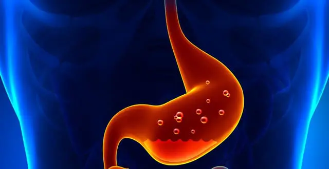 Hôi miệng là bệnh gì? Có chữa trị dứt điểm được không? 2