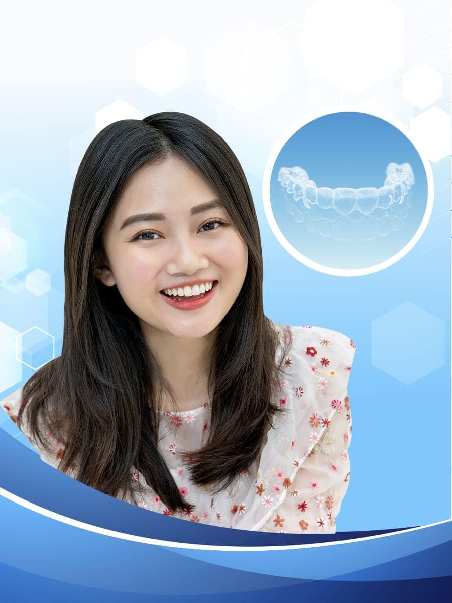 Niềng răng tại Nha Khoa Flora 