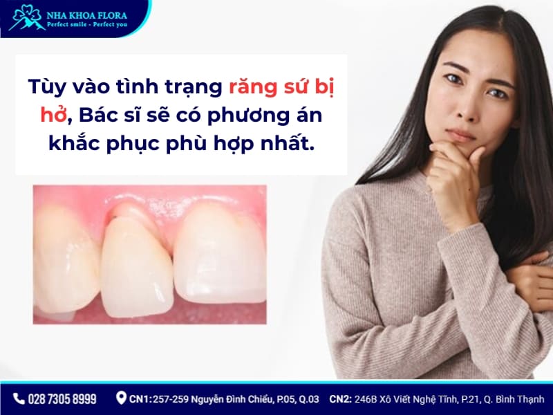 dấu hiệu răng sứ bị hở