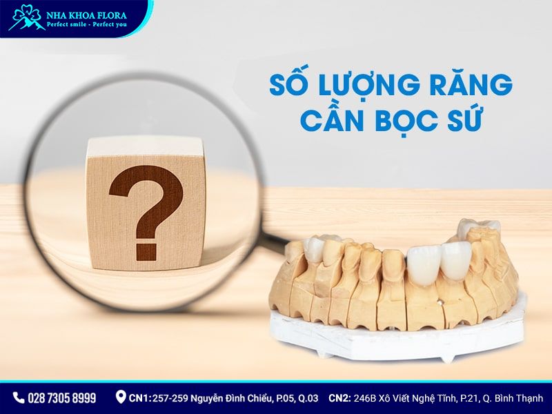 làm răng sứ mất bao lâu 