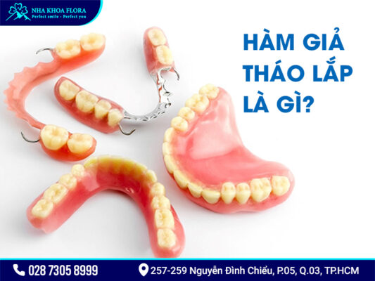 Nên cấy ghép Implant hay dùng hàm tháo lắp? - ảnh 2