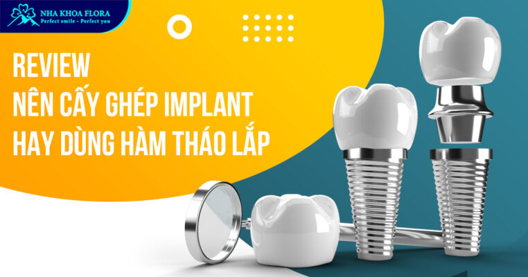 Nên cấy ghép Implant hay dùng hàm tháo lắp