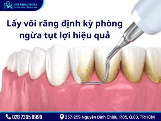 tụt lợi - ảnh 5