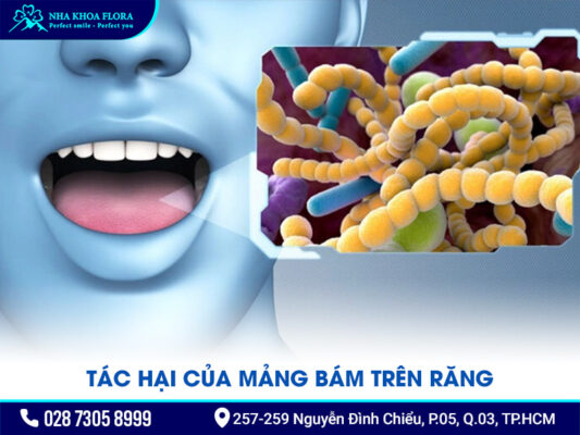 mảng bám trên răng - ảnh 2