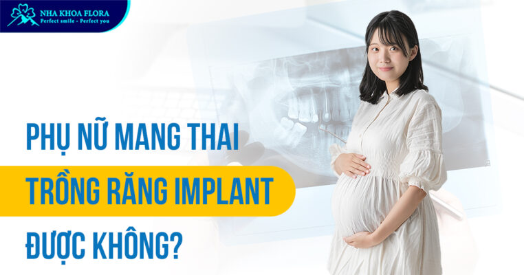 Phụ nữ mang thai trồng răng Implant được không