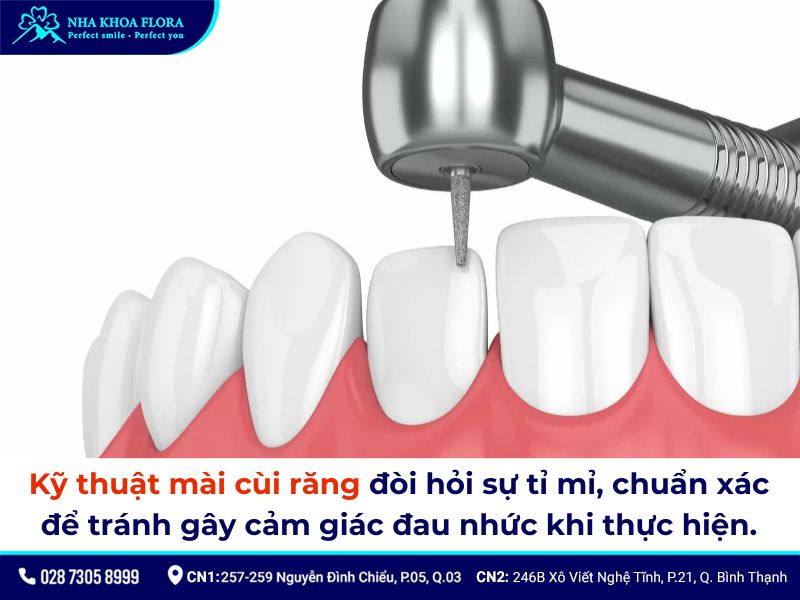 bọc răng sứ có đau không