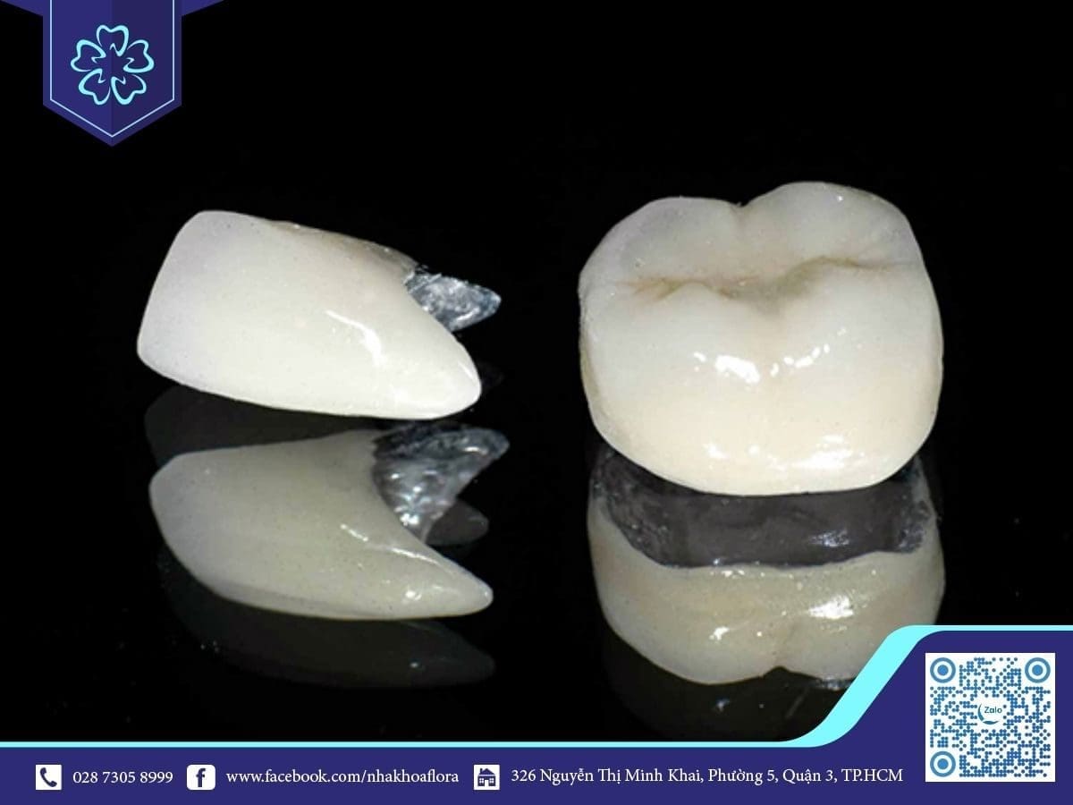 Mão sứ kém chất lượng (ảnh minh họa)