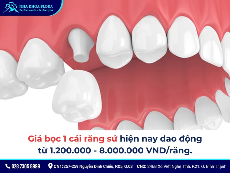 bọc răng sứ 1 chiếc được không