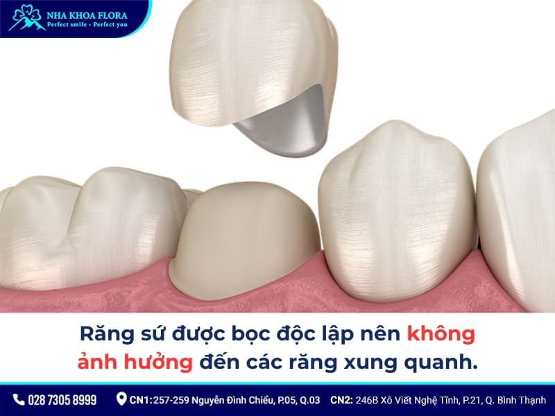 bọc răng sứ 1 chiếc được không