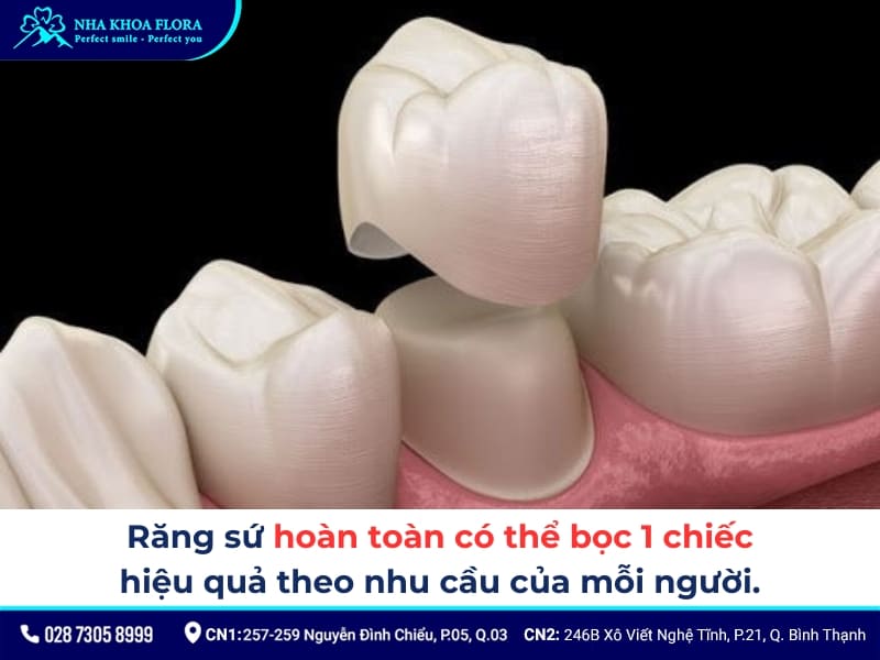 bọc răng sứ 1 chiếc được không