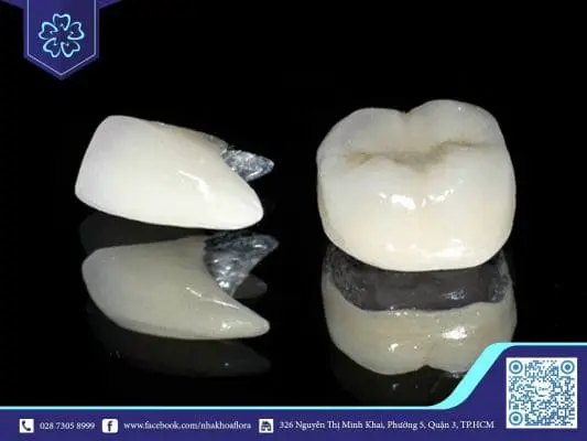 Bọc răng sứ giá rẻ có thật sự an toàn? 1