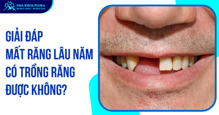 Mất răng lâu năm có trồng Implant được không?