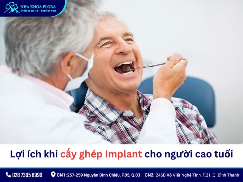 Lợi ích khi trồng răng Implant cho người già