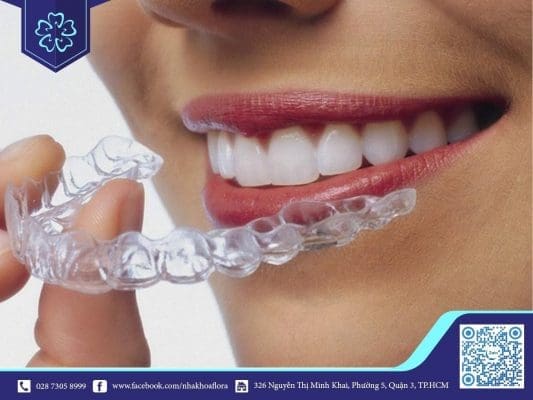 Niềng răng trong suốt